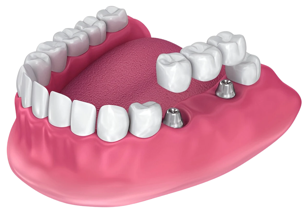 nakshatra dental